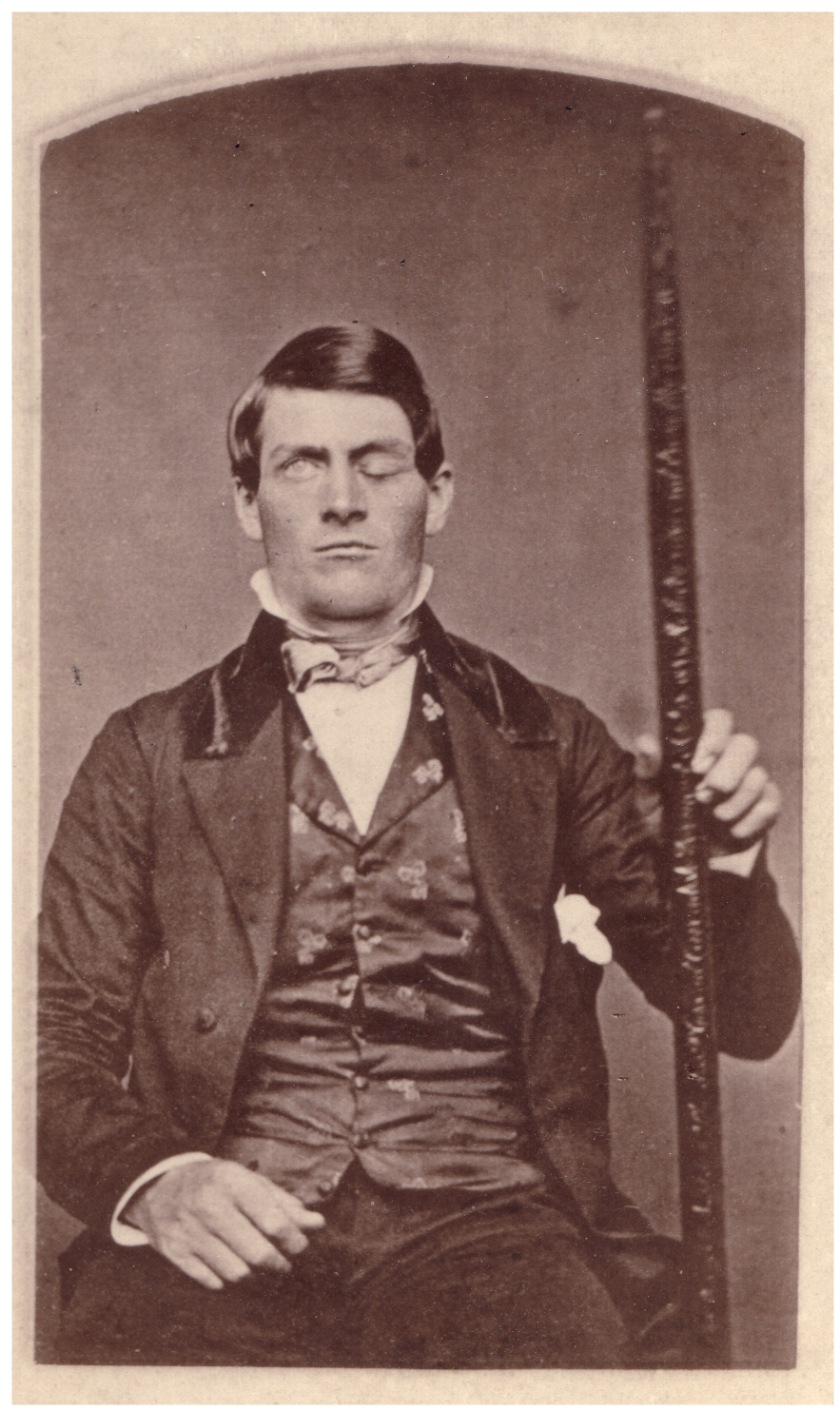 L’incredibile storia di Phineas Gage